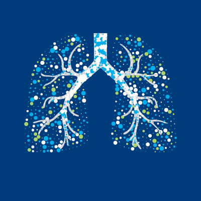 400x400-News-Tuberculosis-lungs